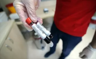 7 milyon kişiye kanser taraması