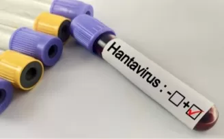 Hantavirüs salgına dönüşür mü? Kapalı alan temizliğinde büyük risk
