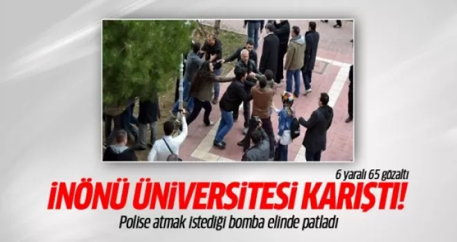 Polise atmak istediği bomba elinde patladı