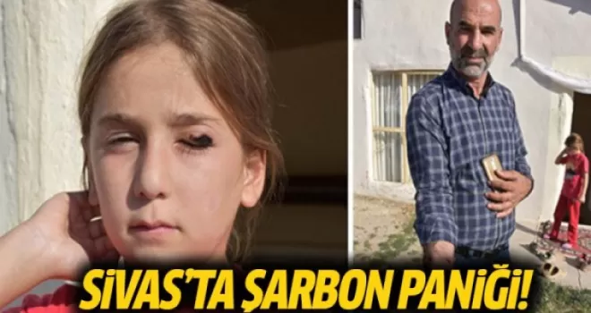 Sivas'ta Şarbon Paniği, Köy Karantinaya Alındı