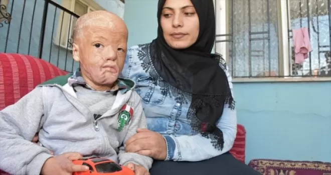 'Yangınımıza bir damla su olmalarını bekliyoruz'